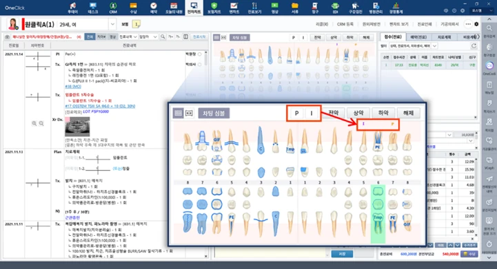 오스템임플란트 치과 의료용 소프트웨어 차팅 화면 — 치아 차트에서 진료 내역을 기록하는 치과 진료실용 소프트웨어 UI